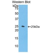 Western blot analysis of recombinant Mouse FOLR4 using Folate Receptor Delta (FOLR4) Antibody.