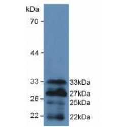 Forkhead Box Protein O1 (FOXO1) Antibody
