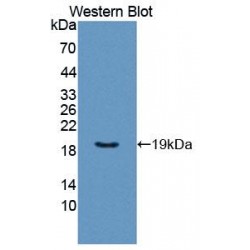 Glycoprotein VI, Platelet (GP6) Antibody
