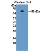 Western blot analysis of recombinant Human Kim1.