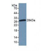 Western blot analysis of recombinant Mouse NFkB2.