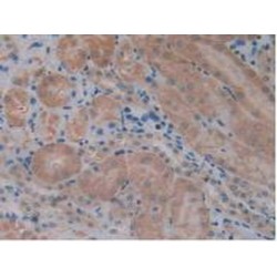 Transcription Factor 20 (TCF20) Antibody