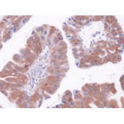 Aspartate Aminotransferase, Cytoplasmic (GOT1) Antibody