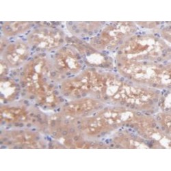 Aspartate Aminotransferase, Cytoplasmic (GOT1) Antibody