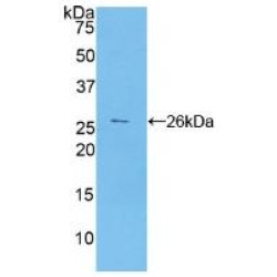 Carbohydrate Antigen 125 (CA125) Antibody