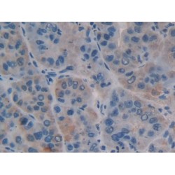 Carbohydrate Antigen 125 (CA125) Antibody