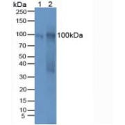 Western blot analysis of (1) Human Hela Tissue and (2) Mouse Ovary Tissue.