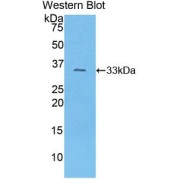 Western blot analysis of the recombinant protein.