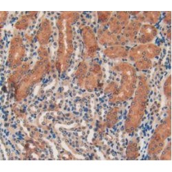 Collagen Type I Alpha 1 (COL1A1) Antibody