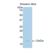 Western blot analysis of recombinant Human CNP protein.