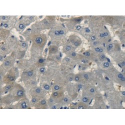 C-Type Natriuretic Peptide (NPPC) Antibody