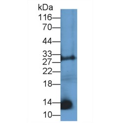 C-Type Natriuretic Peptide (NPPC) Antibody