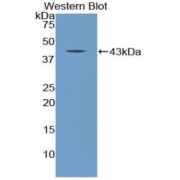 Western blot analysis of the recombinant protein.