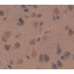 C-Type Natriuretic Peptide (NPPC) Antibody