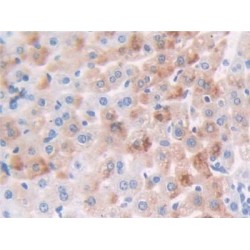 Cyclin Dependent Kinase 1 (CDK1) Antibody