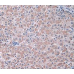 Cyclin Dependent Kinase 2 (CDK2) Antibody