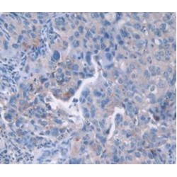 Cyclin Dependent Kinase 2 (CDK2) Antibody