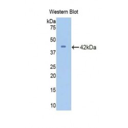 Cyclin Dependent Kinase 2 (CDK2) Antibody