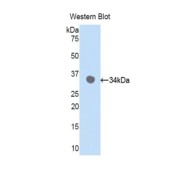 Western blot analysis of the recombinant protein.