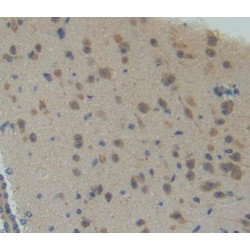 Cyclin Dependent Kinase 7 (CDK7) Antibody