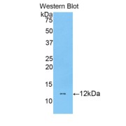 Western blot analysis of recombinant Mouse DBI.