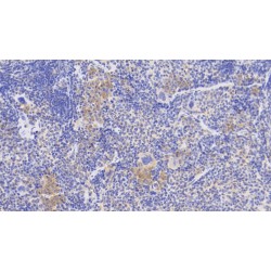 Acyl-CoA-Binding Protein (DBI) Antibody