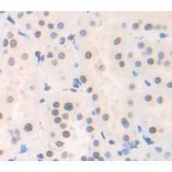 DNA Repair Protein RAD50 (RAD50) Antibody