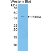 Western blot analysis of the recombinant protein.