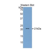 Western blot analysis of the recombinant protein.