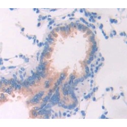 Fibrinogen Like Protein 2 (FGL2) Antibody