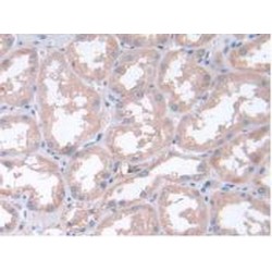 Leukemia Inhibitory Factor (LIF) Antibody