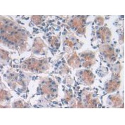 Leukemia Inhibitory Factor (LIF) Antibody