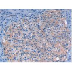 Leukemia Inhibitory Factor (LIF) Antibody