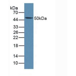 Lymphotoxin Beta Receptor (LTbR) Antibody