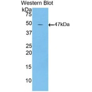 Western blot analysis of recombinant Mouse LTbR.