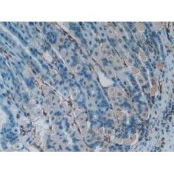 Lymphotoxin Beta Receptor (LTbR) Antibody