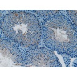 Lymphotoxin Beta Receptor (LTbR) Antibody