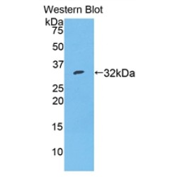 Thyroxine Binding Globulin / TBG (SERPINA7) Antibody