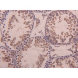 Activin A Receptor Type I (ACVR1) Antibody