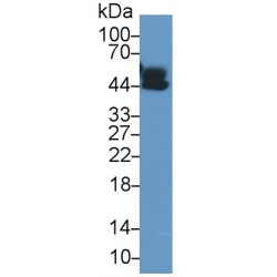 Alpha-1-Acid Glycoprotein (a1AGP) Antibody