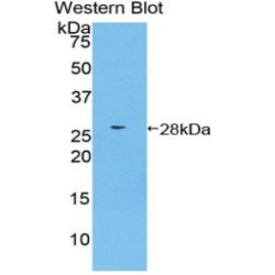 Casein Kinase I Isoform Alpha (CSNK1A1) Antibody