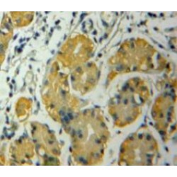 Casein Kinase I Isoform Alpha (CSNK1A1) Antibody