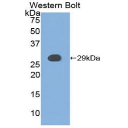 Casein Kinase I Isoform Alpha (CSNK1A1) Antibody