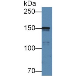 Collagen Type IV Alpha 5 (COL4A5) Antibody