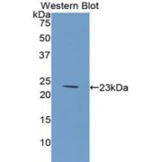 Western blot analysis of the recombinant protein.