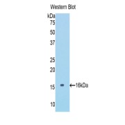 Western blot analysis of the recombinant protein.