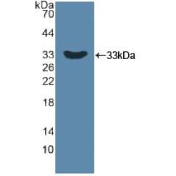 Dickkopf-Related Protein 1 (DKK1) Antibody