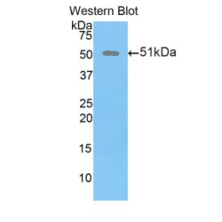 Dickkopf-Related Protein 1 (DKK1) Antibody