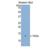 Western blot analysis of the recombinant protein.