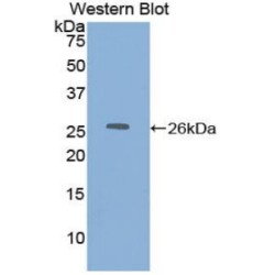 Dihydrolipoyl Dehydrogenase (DLD) Antibody